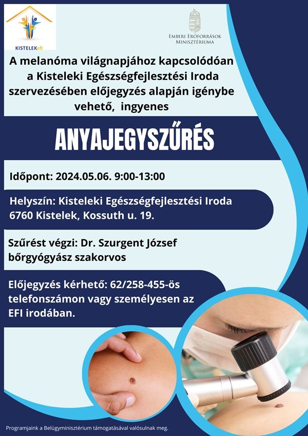 efi_anyajegyszures_plakat_20240424_ck